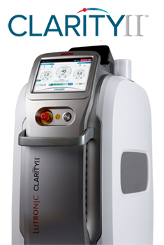 Clarity II Laser